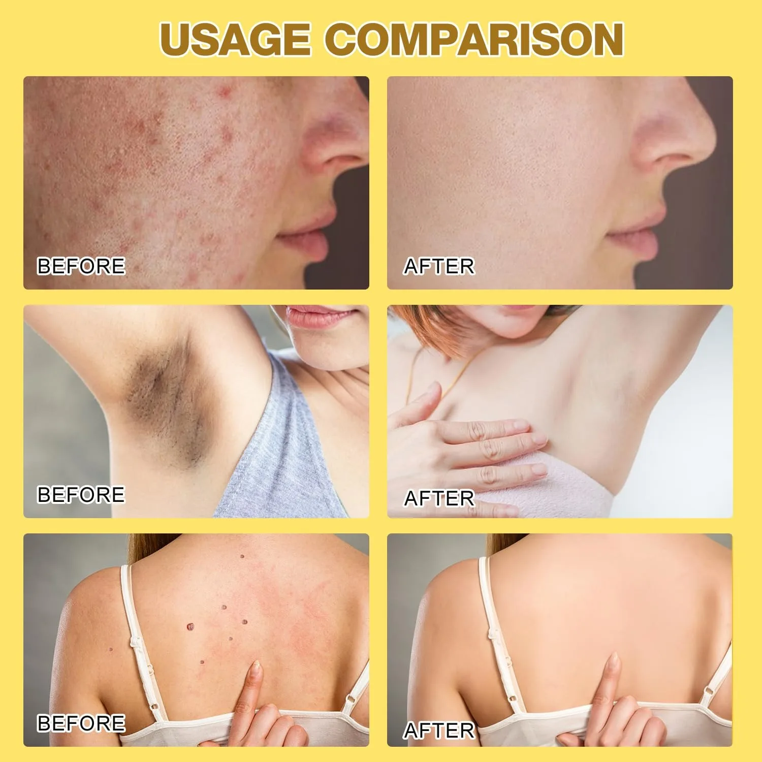 Before and after usage comparison of Bee Venom Skin Treatment Cream on skin concerns