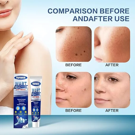 Comparison images showing skin before and after using the Wart Remover Ointment