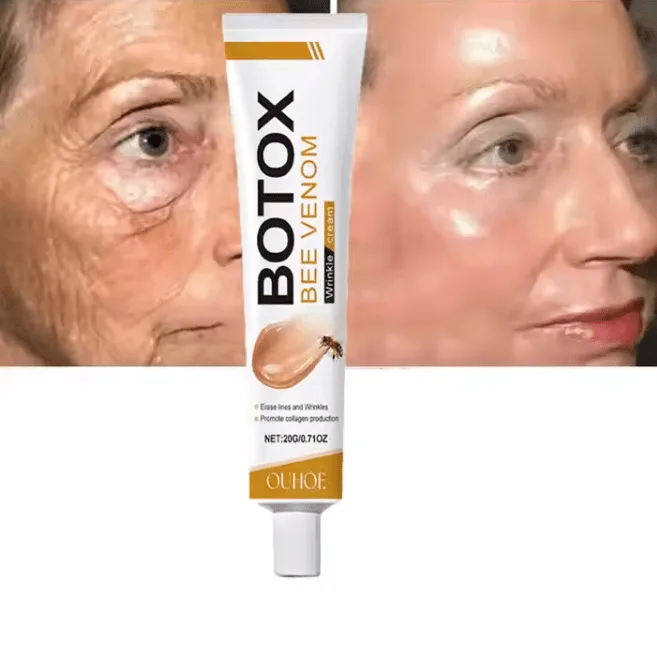 Before and after comparison of skin treated with OUHOE wrinkle cream
