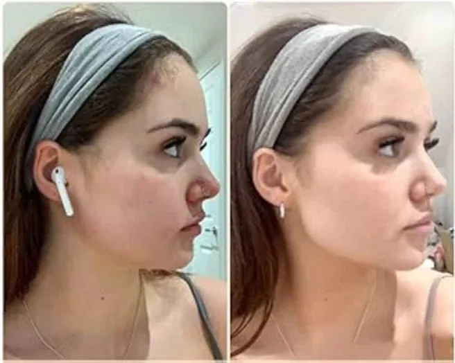 Face Massager © 8